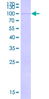 12.5% SDS-PAGE Stained with Coomassie Blue